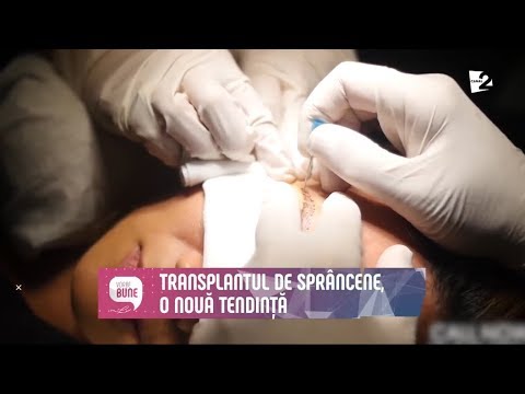 Video: Sprâncene perfecte: râsul și transplantul 3D sunt în tendință