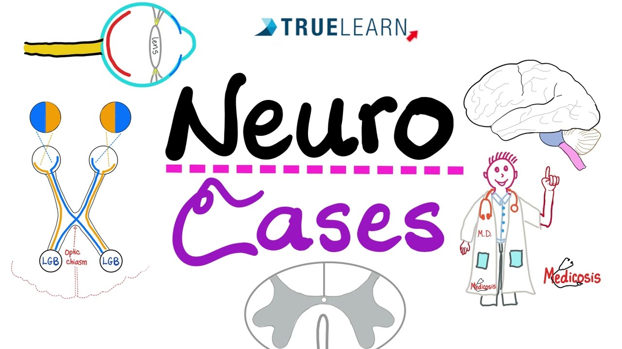 Neuro Cases (with answers)- TrueLearn Qbank - Vignettes