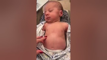 Dấu hiệu rút lõm lồng ngực