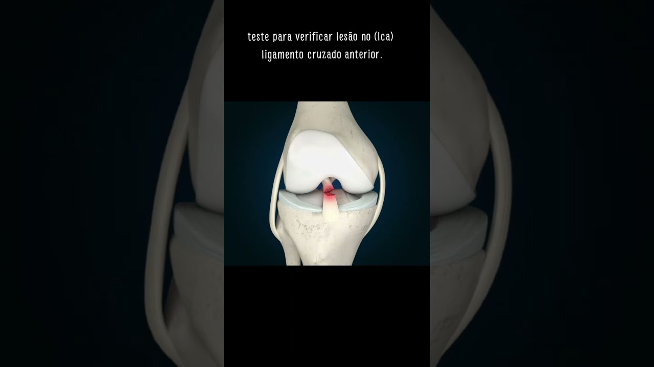 Teste de Lachman conhece? 