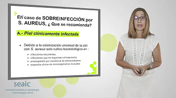 ¿Cuándo es grave una infección bacteriana?