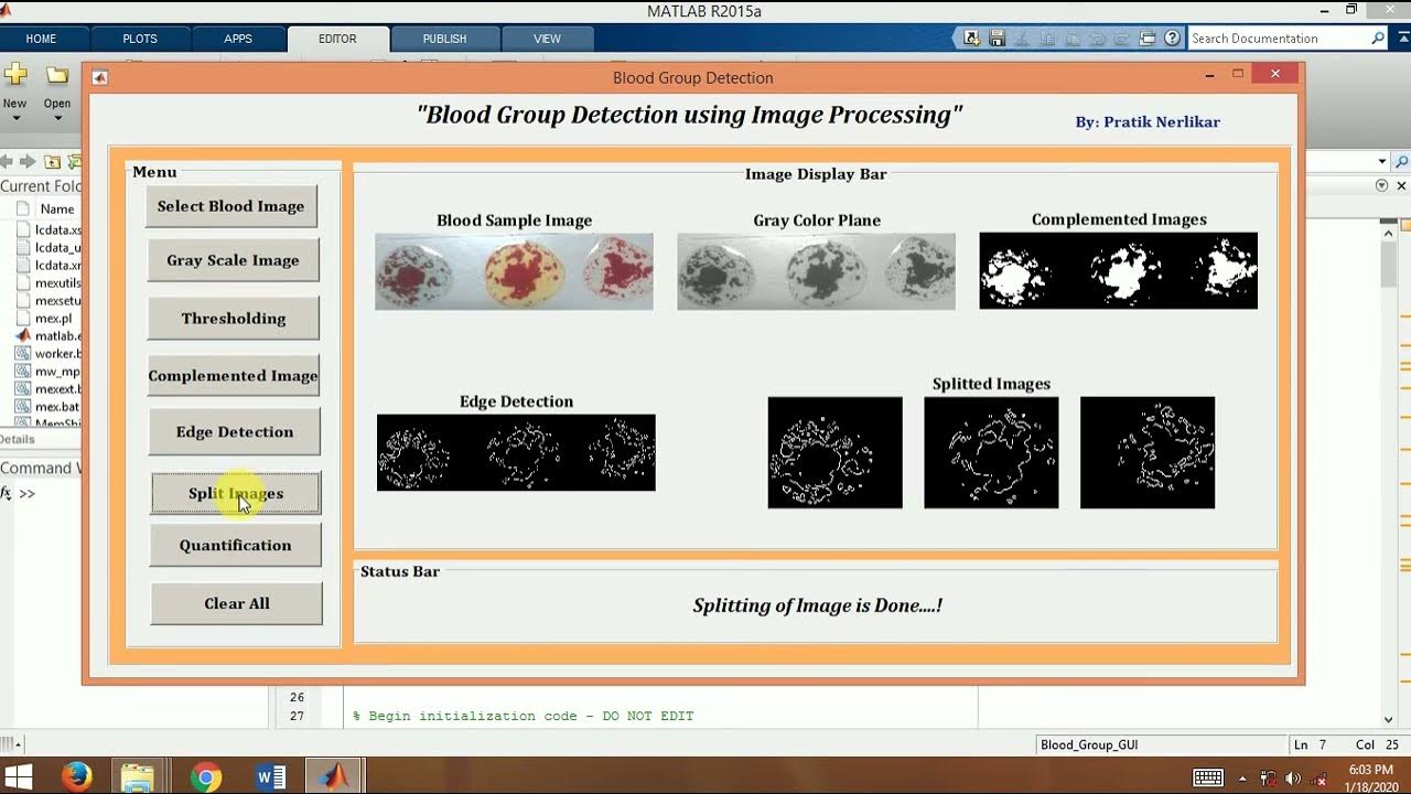 Blood Group Detection Using Image Processing By Edge Detection Method ...