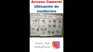 Acceso Cameral y ubicación de conductos radiculares