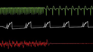 COMMODORE C64 SID -2020- BASS SPENCER & TRANCE HILL Lalalalalala 8bit 😂-CHRIS-DO / Oscilloscope View