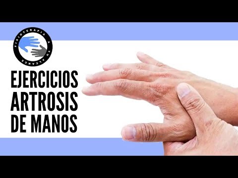 como eludir artrosis linear unit las manos