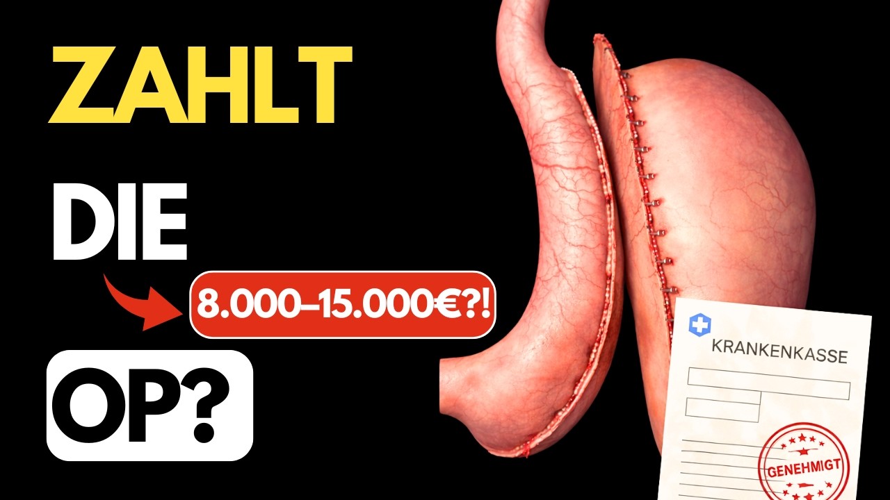 Abnehmen mit OP: Was kostet eine Magenverkleinerung – und zahlt die Krankenkasse?