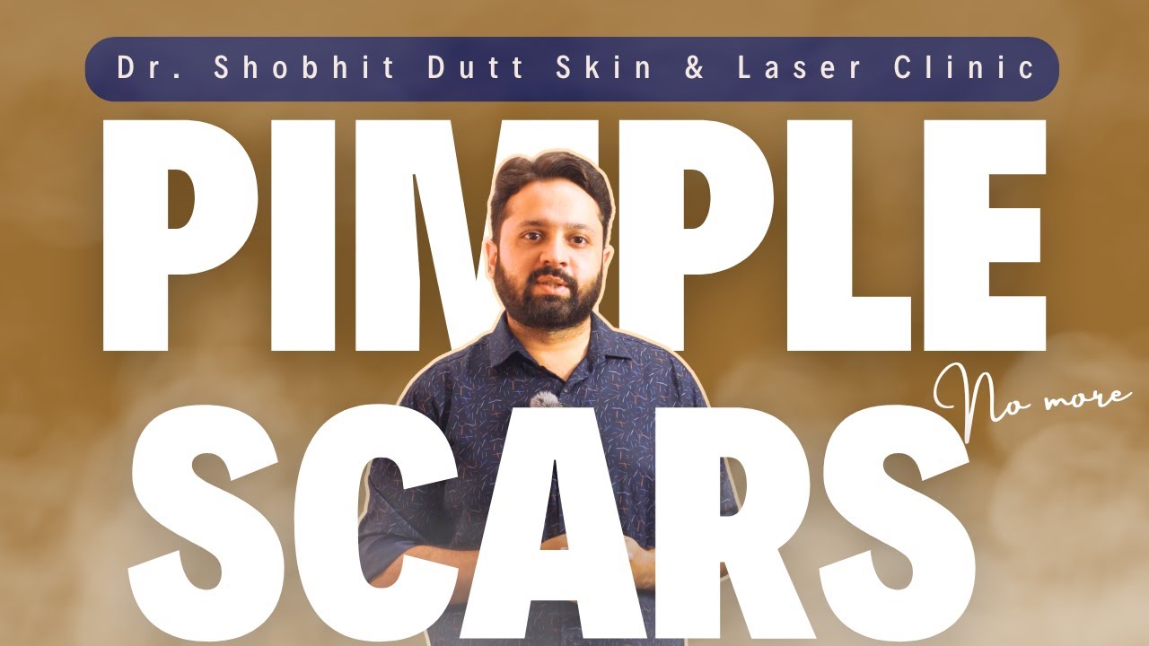 No more Pimple & Scars || Types of Acne treatments || Lasers for acne scars || Dr Shobhit Dutt