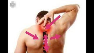 Tbc1 Hatari Pikipiki Zinasababisha Homa Ya Uti Wa Mgongo, Daktari Aelezea..