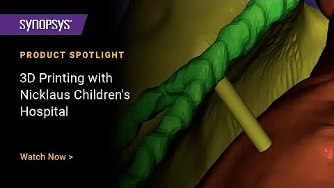 Point of Care 3D Printing of Hearts with Simpleware Software