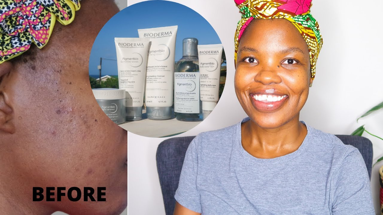 BIODERMA PIGMENTBIO RANGE REVIEW DOES IT GET RID OF DARK SPOTS? 