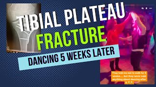 Tibial Plateau Fracture - How I Was Dancing After 6 Weeks!