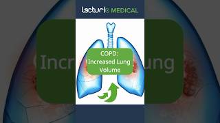 🌬️ COPD & Increased Lung Volume! #COPDawareness #LungHealth #usmle