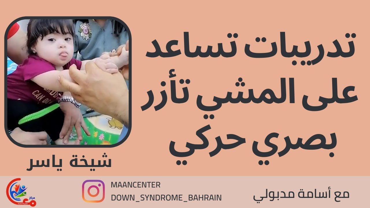 تدريبات تساعد على المشي وتأزر بصري حركي لطفلة لديها متلازمة داون | مع اسامة مدبولي