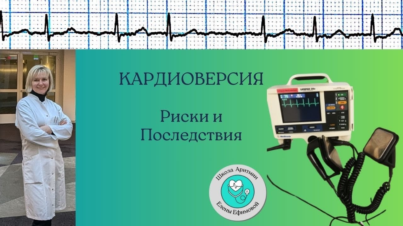 Кардиоверсия Риски и Последствия