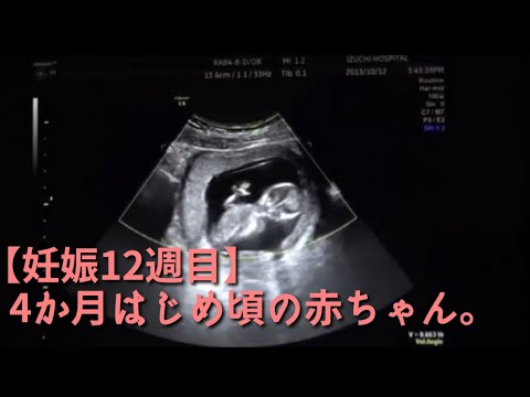 妊娠12週目 4か月はじめ頃 のあかちゃん Youtube