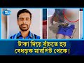 ভাগ্যের আশায় দুর্ভাগ্যের খপ্পরে, টাকা দিয়ে বাঁচতে হয় মারধর থেকে | Rtv News