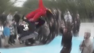 Kid Gets Hit In The Face With A Skateboard