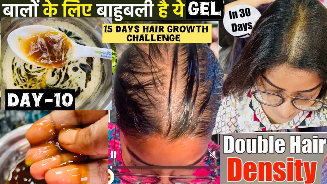 ✨DHT Blocker To Stop Hairfall And Boost Hair Growth👍Day-10❤️15 Days Hair Growth Challenge