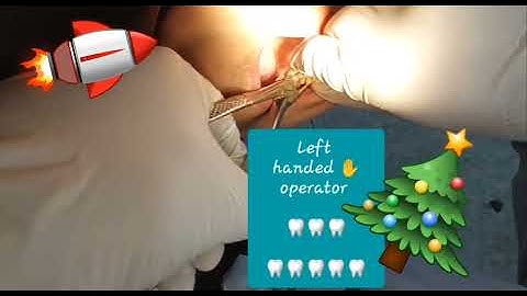 Support palatally and deep firm Grip are very important principles for better luxating extraction 