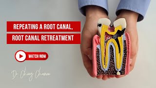 Repeating a root canal treatment? Root-canal re-treatment may be necessary | Dr Chirag Chamria