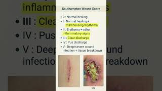 Southampton scoring #inicet #neetpg #usmle #education #surgery #mbbs #study #learning #doctor