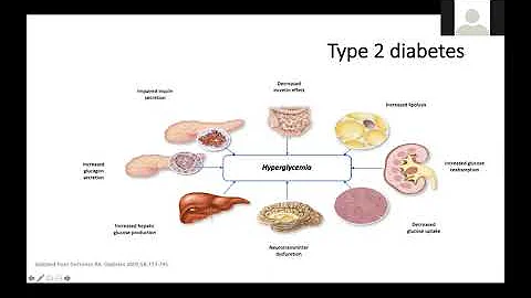 Standards of Medical Care in Diabetes 2020 - DayDayNews