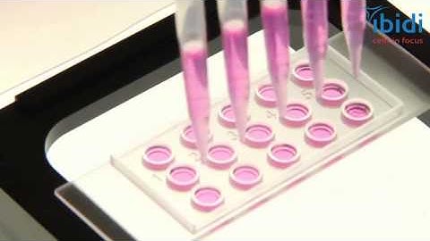 ibidi   cells in focus  Performing an Angiogenesis Assay