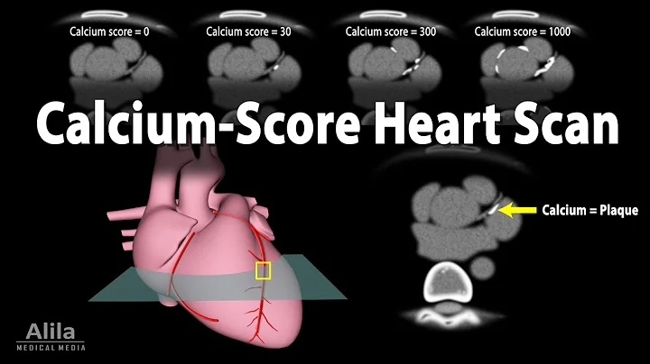 Calcium Score Heart Scan, Animation