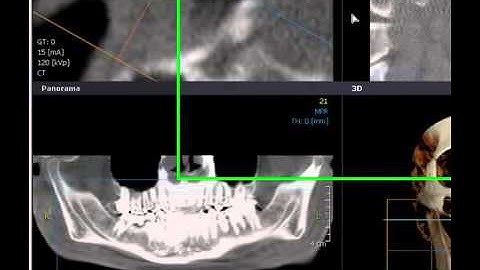 General Tool: MeasureAngle /3D angle/ 3 Point/ 2 lines