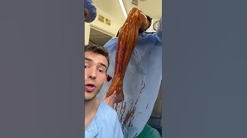 Thumbnail of I've never worked in an operating room #shorts