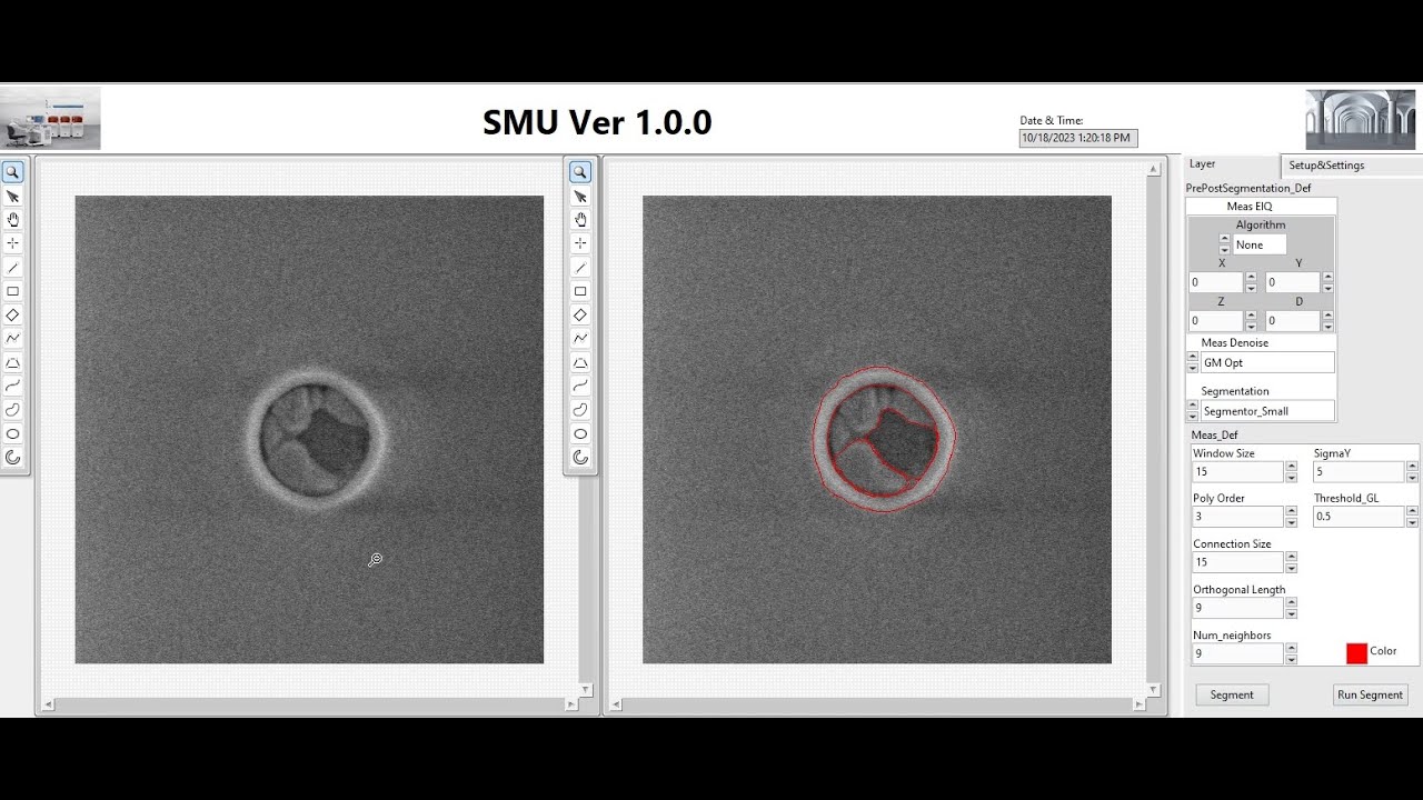 Segmentor Mix Model Seg Small