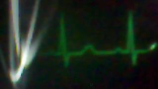 Rdb 2009 Ticino Switzerland