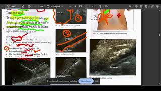 TECHNIQUE FOR ABDOMINAL SONOGRAM PART 1 BY DMN ACD EXPLANATION BY Dr MUHAMMAD NASEER .
