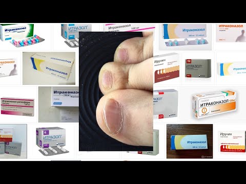 Как долго принимать препараты от грибка ногтей