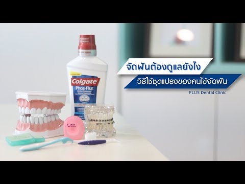 คนไข้จัดฟันต้องใช้ชุดแปรงดูแลฟันยังไง??