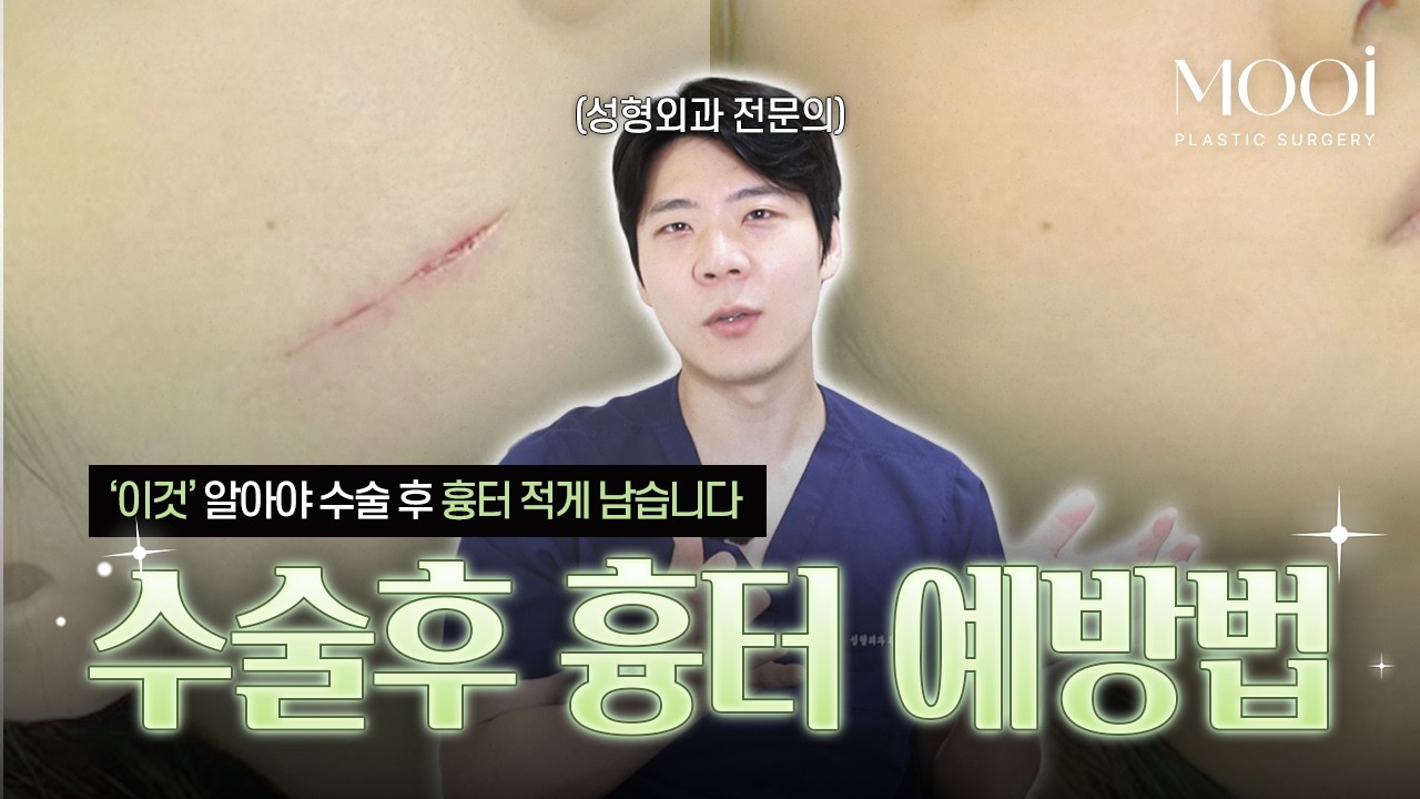 수술 후 흉터가 걱정된다면 꼭 보세요.｜무이성형외과 #흉터