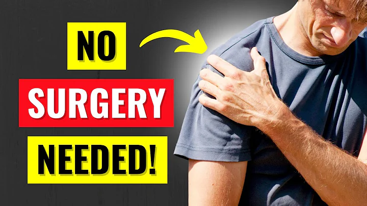 How to Heal a Rotator Cuff Tear Without Surgery