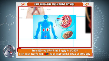 [🔴Live] Sức khỏe của bạn: "Phát hiện và điều trị sỏi đường tiết niệu”