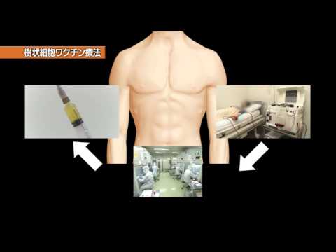 2015年12月26日放送 特集企画「医療のチカラ」 がん免疫細胞療法②　樹状細胞ワクチン療法