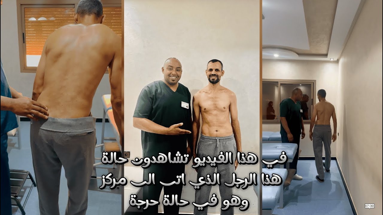 بعد مرور 18 سنة من الالم الحاد😢, تم شفاء هذا المريض من السياتيك😃