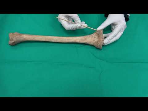 Anatomi Kemikler-Alt Ekstremite Kemikleri-Os Tibia Anatomisi (kemikler anatomi)