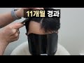 612번 비절개3000모11개월 Dr.정우석