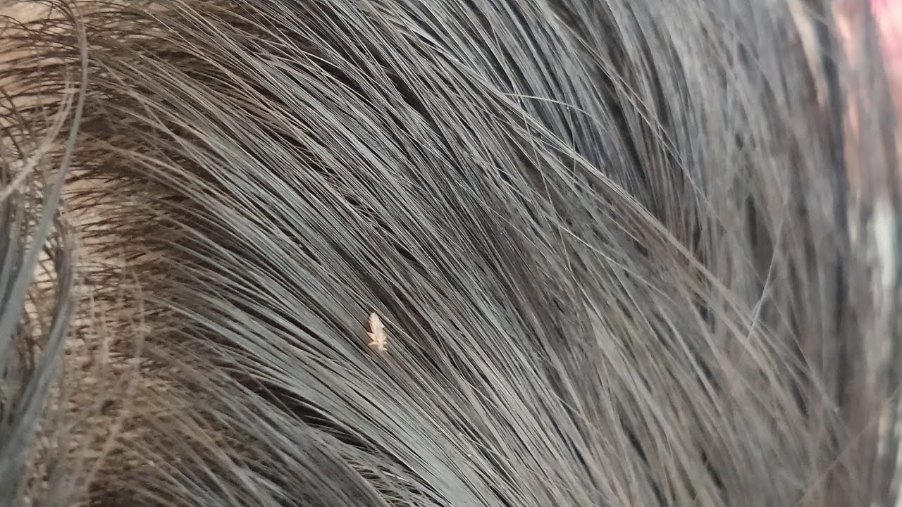 long and curly hair heavy nitpicking heavy nits heavy picking // in