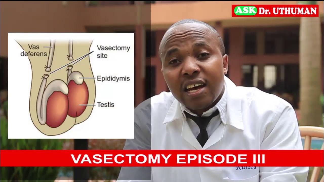 Difference Between Castration And Vasectomyvasectomy Episode Iiibenefits Of Vasectomy Can I