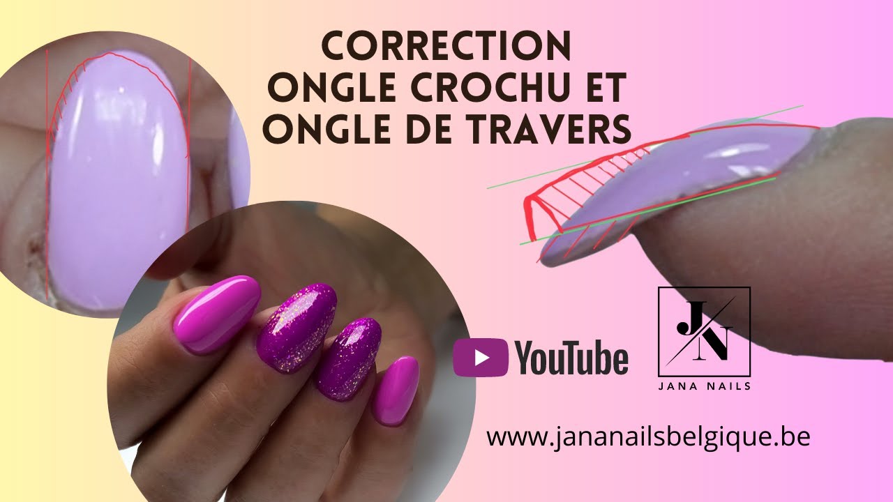 Correction ongle crochu et ongle de travers 💅