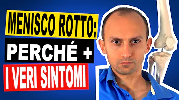 In che punto si trova il menisco?