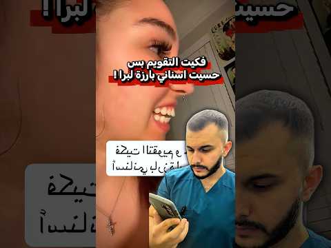فكت التقويم بس اسنانها بعدهم بارزات
