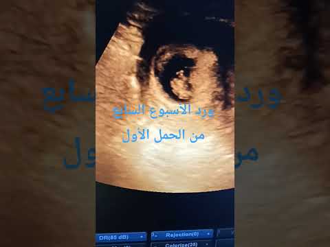 ورد الأسبوع السابع من الحمل الأول