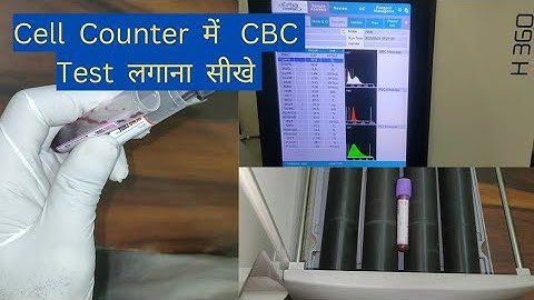 How to run CBC sample on the cell Counter  | CBC Test