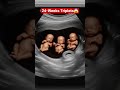 24 Weeks Ultrasound Scan of Triplets Fetuses | 6 Months Rare Pregnancy #shorts